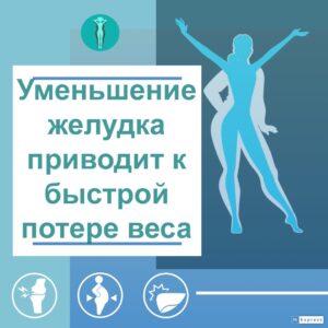 Уменьшение веса изображения онлайн